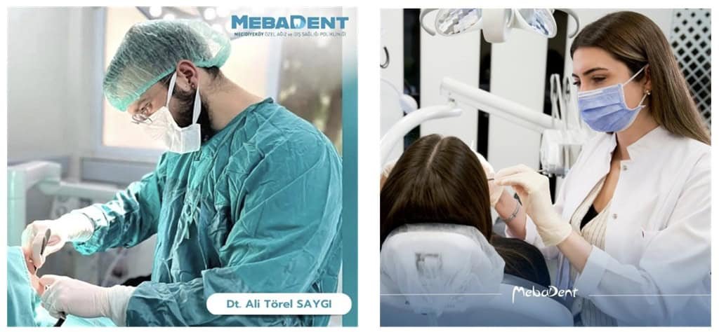 Dental implants and advanced treatment options offered at Mebadent Dental Clinic in Istanbul, highlighting quality care and patient satisfaction.